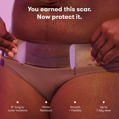 OVELLA — Silicon Scar Patches